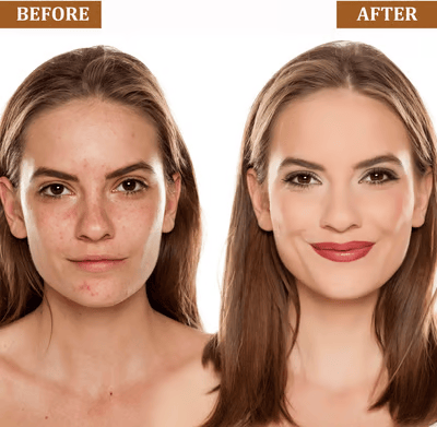 ✨BUY 1 GET 1 FREE — 3-in-1 Color-Adjusting Foundation Stick for Pores, Redness & Uneven Skin Tone