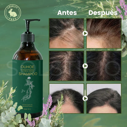 Detiene la Caída, la Irritación y la Sequedad – Shampoo de Romero con Acción Regenerativa