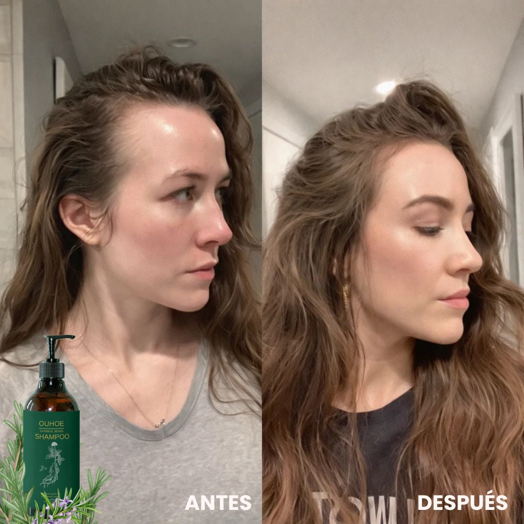 Detiene la Caída, la Irritación y la Sequedad – Shampoo de Romero con Acción Regenerativa