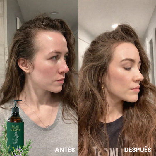 Detiene la Caída, la Irritación y la Sequedad – Shampoo de Romero con Acción Regenerativa