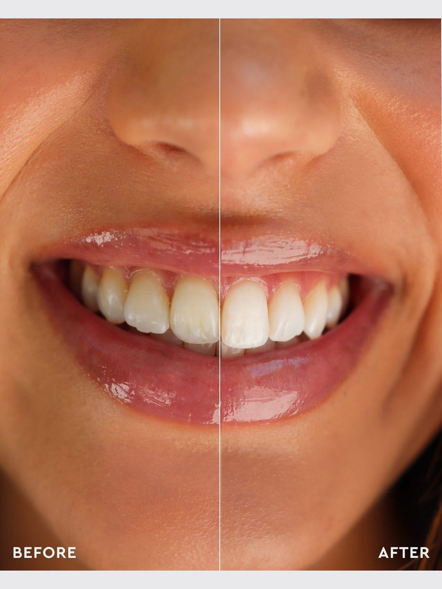 ✨ Next-Gen Dissolving Whitening Strips | Upgraded Formula, Zero Sensitivity 🦷